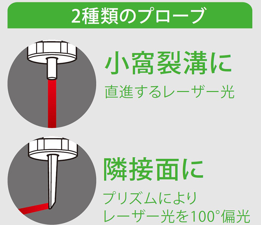 Pickup虫歯の進行度を数値化